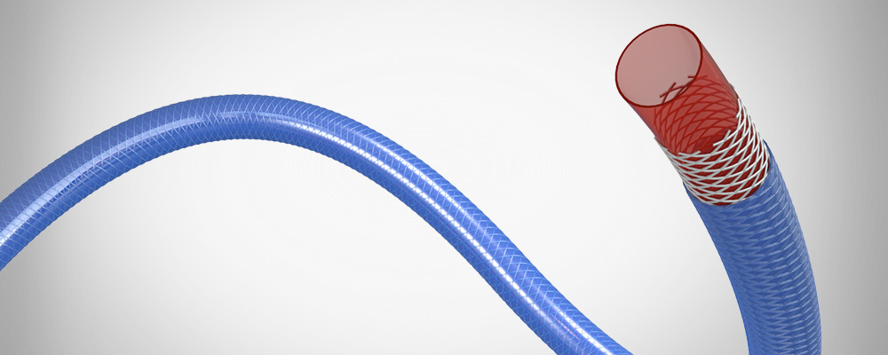 Reinforced Tubing - Our braid-reinforced microtubing is fabricated using the film-coat process developed for polyimide tubing