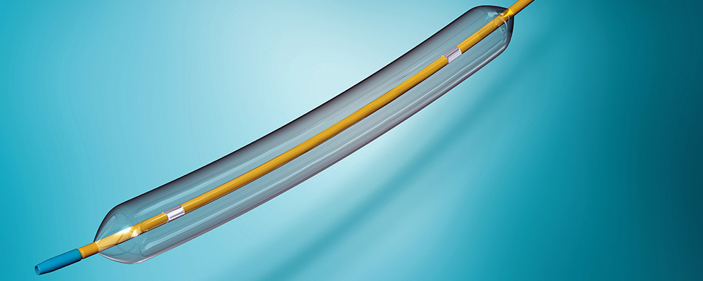Catheter & Cannulae - Single-Source Solution for Catheters and Coatings