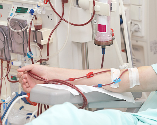 Dialysis Market