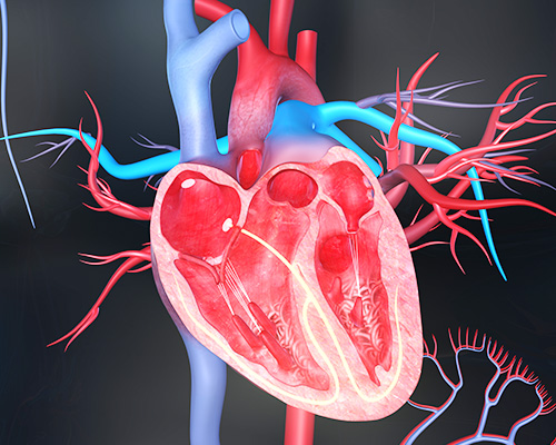 Left Atrial Appendage (LAA) Closure