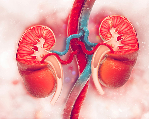 Mechanical Lithotripsy